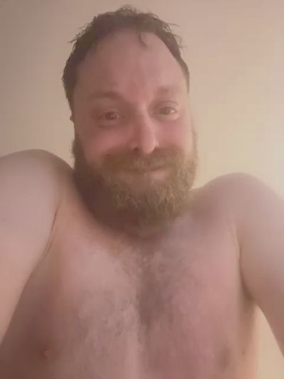 alopeco1dX live cam on Cam4